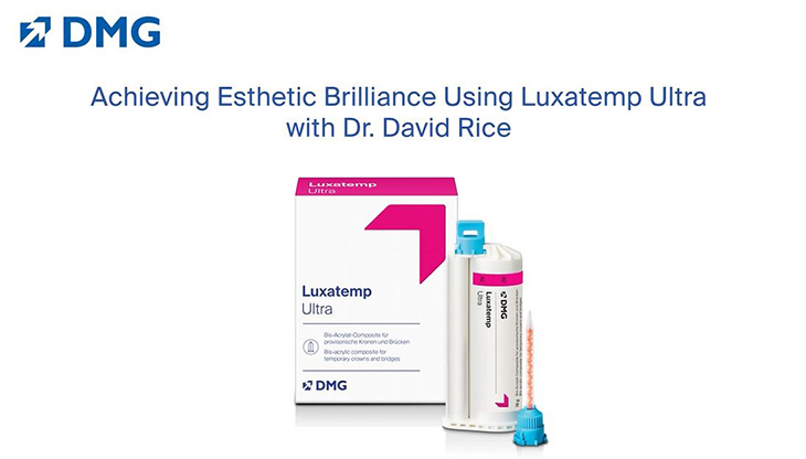 Achieving Esthetic Brilliance Using Luxatemp Ultra with Dr. David Rice