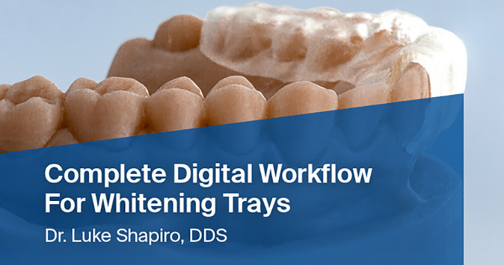Complete Digital Workflow For Whitening Trays
