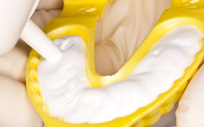 Kolorz Neutral Fluoride Foam 2 Sodium fluoride with neutral pH