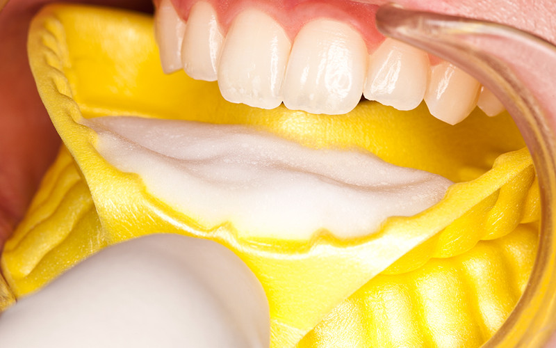 Kolorz Neutral Fluoride Foam 2 Sodium fluoride with neutral pH